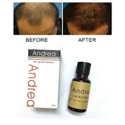 20ML ANREA HAIR GROWTH ESSENCE